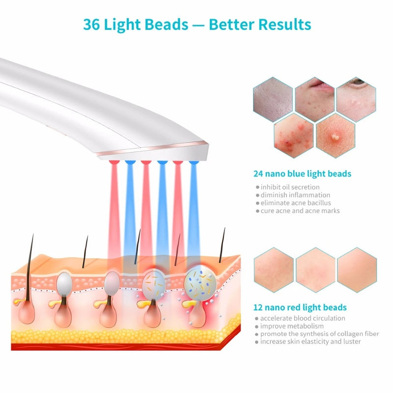 Acne Light Therapy Xpreen Wireless Rechargeable Light Acne Treatment Device Acne Clearing Eraser with Blue Light and Red Light 1619578505162
