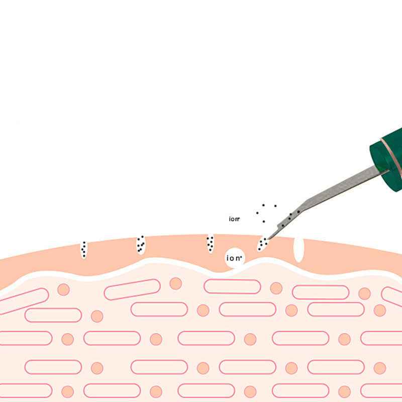 Ultrasonic Skin Rejuvenation Whitening Shoveling Machine Exfoliating Skin Care b8e7f0f8-ecdb-4d14-b44a-22570301df50