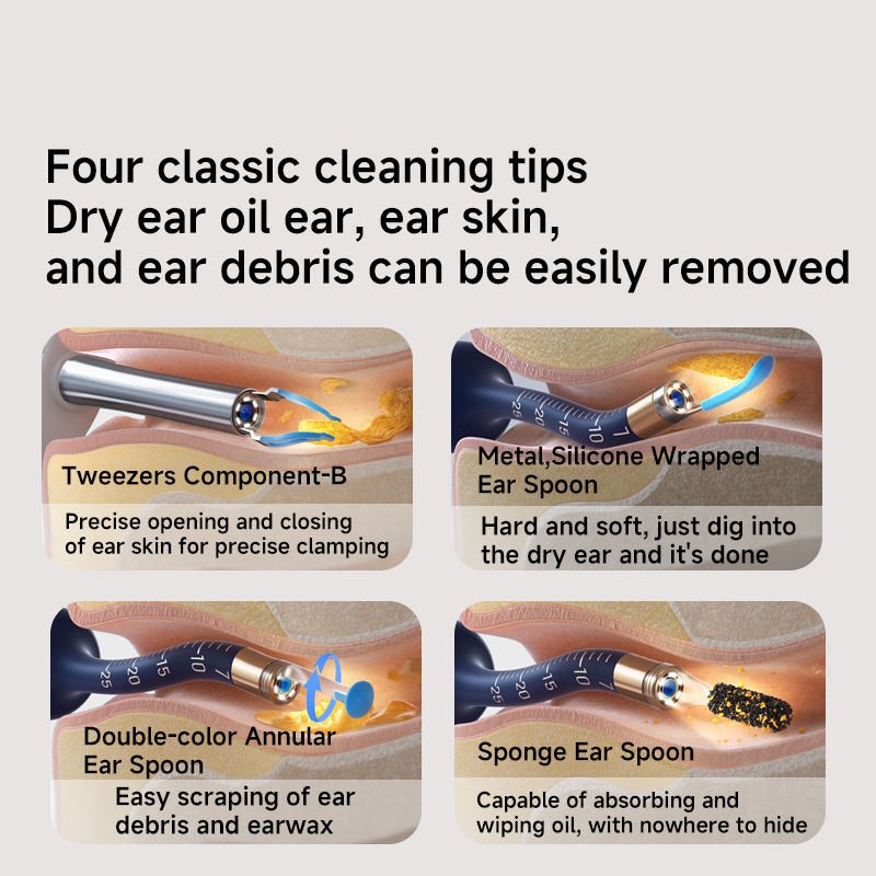 Bebird EarSight Plus Earwax Removal Tool Ear Canal Cleaner, Equipped With A Camera For Ear Nose Throat Examination. - NOMAN STORE LLC